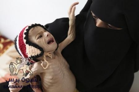 ,, أوكسفام ,, : نصف سكان اليمن مدينون من أجل شراء الطعام