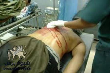 استشهاد حسام محمد حسن وعمر مشعن برصاص الامن اليمني في العاصمة عدن قبل لحظات