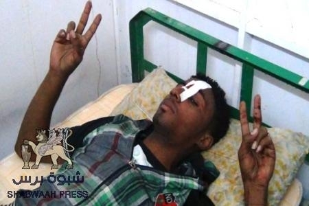 جريح سيئون سعيد فرج الزبيري يغادر المشفى بعد إجراء الاسعافات اللازمة ( صورة الجريح )