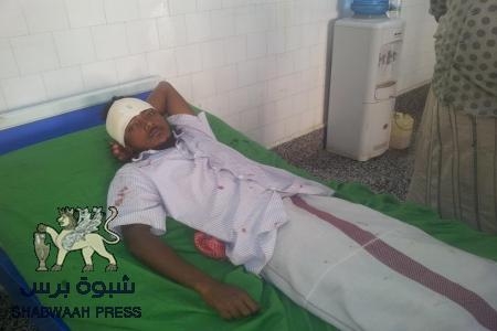 عاجل : أصابة شاب في بداية ثالث أيام العصيان المدني بسيئون