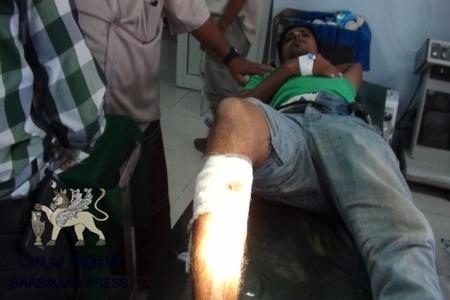 قناصة من قوات الاحتلال تعتلي البنك المركزي بالمكلا وتصيب شاب بالرصاص الحي‎