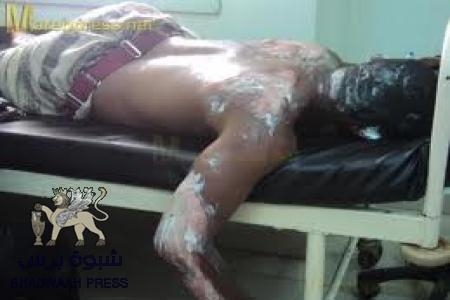 5 قتلى في مواجهات بين الجيش اليمني وعناصر القاعدة بابين
