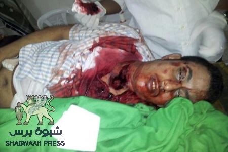 قتيل وأربعة جرحى في المكلا بجوار قيادة المنطقة الشرقية في خلف