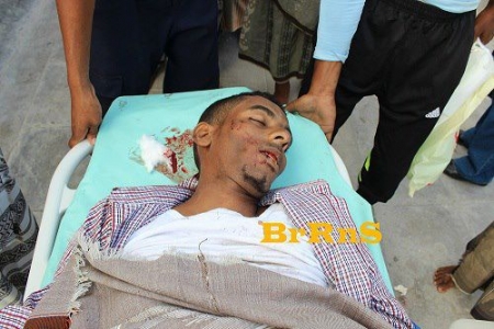 وفاة شاب حضرمي بعد دهسه من قبل سيارة جيش يمني في المكلا