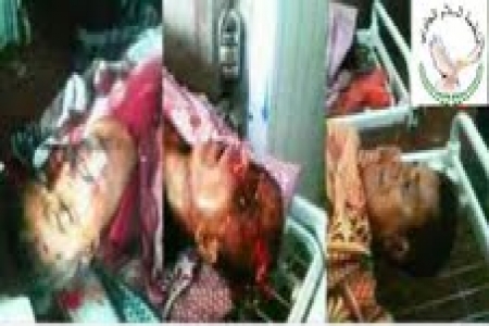 منظمة السلام الجنوبي تدين استمرار عمليات الاغتيالات للكوادر الجنوبيه من قبل عناصر مجهوله وتقاعس الاجهزه الامنيه بالقيام بدورها.