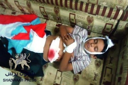 حزب الاصلاح اليمني يسعى لمذبحة جديدة في عدن وشباب شبوة يشترون أكفانهم