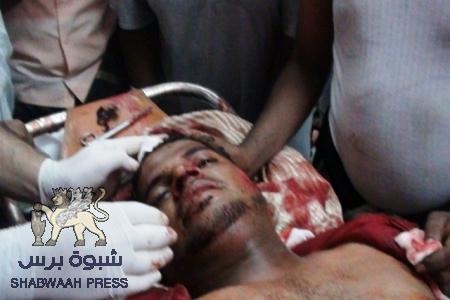 التوتر يسود المكلا بعد مصادمات مع قوات البحرية اليمنية والسبب معاكسة جنود البحرية لامرأة (صور)