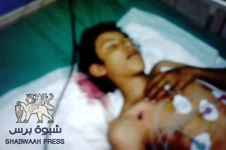 الامن اليمني يصيب طفلا يافعيا بالرصاص كان في طريقه الى عدن