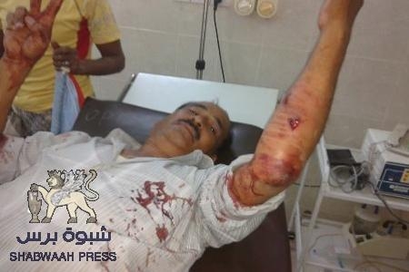 قوات الجيش اليمني تطلق النار على أبناء تريم العائدين من عدن وتصيب عبدالقادر الكاف