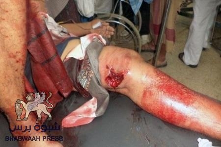 تدهور الحالة الصحية للجريح الأبكم ثابت بن جوهر وأسرته تحمل صندوق الاغاثة مسؤولية ذلك