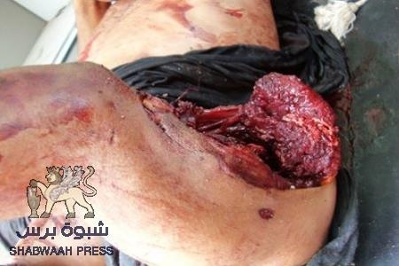صنعاء تستنفذ جميع اوراقها ازاء الجنوب .. وتعلن الحرب !