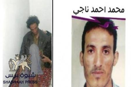 سلطات صنعاء تقوم بإخفاء شاب جنوبي لمدة 10 أشهر وتطلقه فاقدا للذاكرة وحالته مزرية