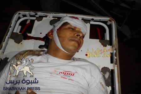 عاجل :مقتل مواطن بتعز امام طفله