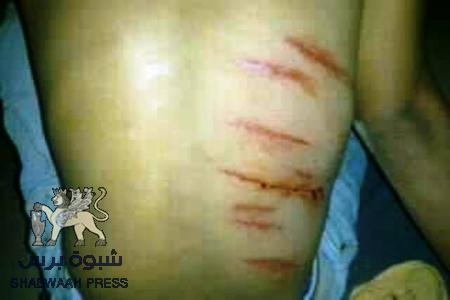 بلاطجة شماليون يعتدون بالضرب على شاب جنوبي في العاصمة اليمنية صنعاء( صور )