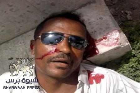 تقرير ومؤشر خطير : (33) قتيل و (27) إصابة حصيلة شهر جراء عمليات إرهابية في حضرموت .