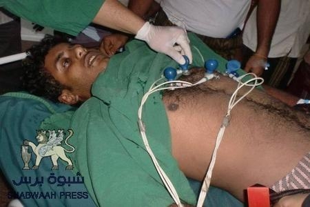 صور وتفاصيل عن الجرحى من أبناء شبوه بمستشفى صابر