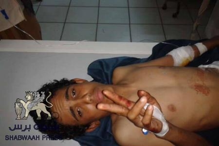 حزب الرابطة يدين الاعتداء على موكب جماهير شبوه الى عدن