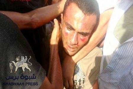 وفاة الشاب محمد صالح سالم متأثرا بالضرب الشديد الذي تعرض له في ساحة العروض عصر اليوم