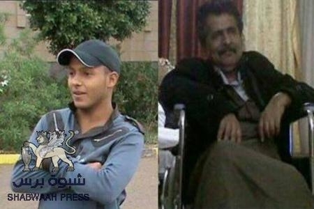 3 وفيات بمرض السرطان الغامض بمنطقة المصينعة بشبوه خلال اسبوعين