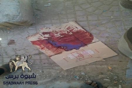 قوات الأمن والشرطة  العسكرية تطلق النار على المواطنين وسقوط جريحين بعتق (صور)