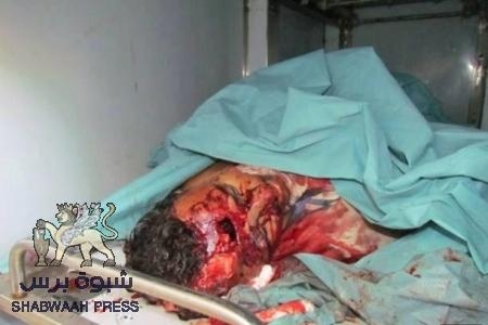جنون الأمن اليمني يردي الشهيدة إيناس بامحيسون أمام بناتها وهي ذاهبة لحضور عرس بالمكلا