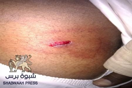 عنصرية صنعاء : جنوبي يشكو مضايقات من السكان وتعسف السلطات الأمنية (ملف صور)