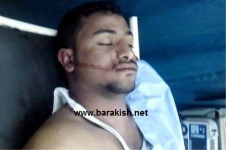 يقتلون ولا يعتقلون : مسلحين يعملون لأولاد الأحمر يقتلون سائق سيارة حكومية