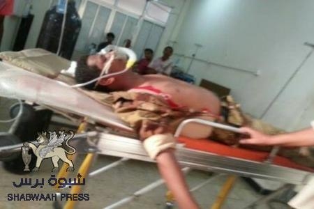 عاجل : ‘‘ شبوه برس ‘‘ ينشر الصور الأولى لقتلى وجرحى معارك الشحر