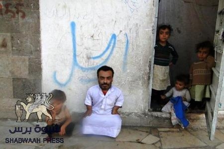 ممثل يمني يخرج عن صمته ويناشد الحكومة بانقاده من وضعة  المتدهور