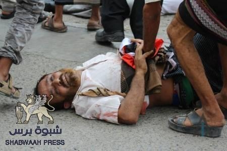 ‘‘نايف الكلدي‘‘ جرح الوطن النازف ... ومناضلي فنادق الـ 5 نجوم !!