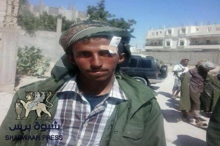 شهيد شبوه  ‘‘محمد أحمد سالم العبدلي العولقي‘‘ حي يرزق