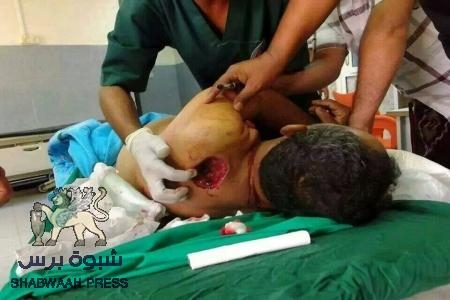 بلاغ لعناية منظمات حقوق الإنسان الدولية ونشطاء وانصار الإنسانية في العالم