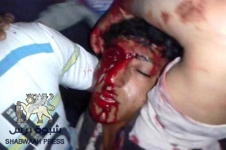 عاجل:إصابة طفل في الـ 13برصاصة في الرأس أثناء مطاردة قوات من الأمن نشطاء من الحراك الجنوبي في حي التواهي بعدن