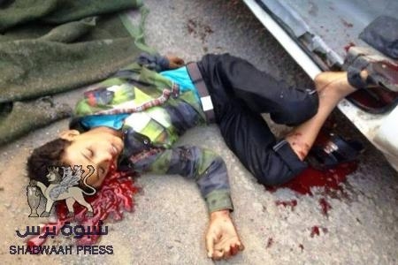 (4) شهداء ونحو (23) جريحاً..الضالع بوابة الجنوب الشمالية ..في مواجهة "ضبعان" والراقصون على أشلاء وجثث الأبرياء