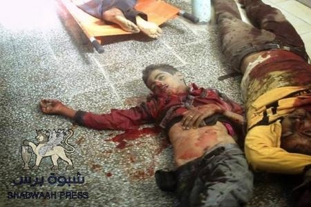 جيش الاحتلال اليمني يلجأ لأساليب الصهاينة في ممارسة شهوة القتل (صور بشعة )