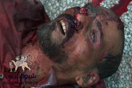 من الجمعة الى الجمعة 37 قتيلاً : قوات الجيش اليمني تنفذ مجازر إبادة ضد الجنوبيين .