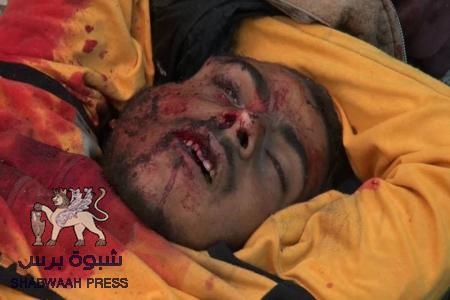بيان ائتلاف قوى الثورة السلمية الجنوبية بشأن مجزرة الضالع