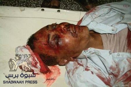 الاصنج: جريمة ‘‘الضالع‘‘ لا يمكن لها أن تمر ولن نقبل السكوت أو التغاضي عنه