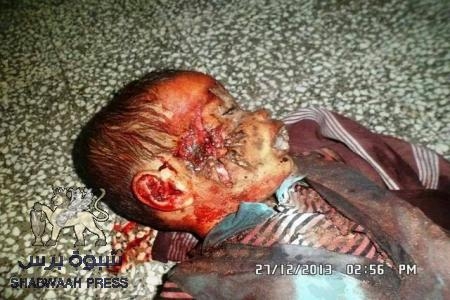 الجزيرة : قتلى وجرحى في مظاهرة بجنوب اليمن اليوم