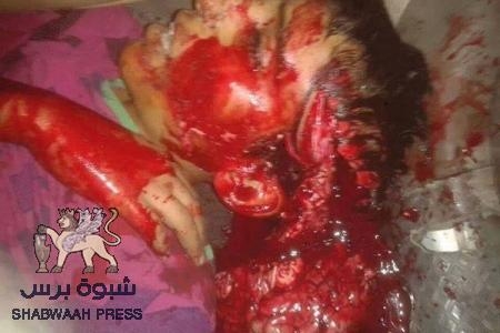 التحالف الدولي يستنكر مقتل طفل بعدن ويعد بملاحقه المتورطين