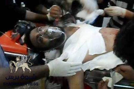 اشتباكات عنيفة في الضالع والجيش يستخدم الأسلحة الثقيلة لقصف مواقع يتحصن فيها مسلحون قبليون