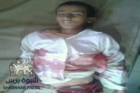 استشهاد الطفل عبداللاه عبدالكريم ناصر في الضالع
