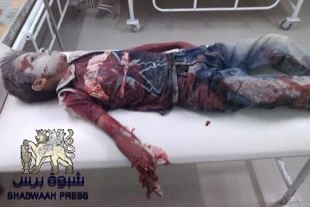 زوامل متبادلة حول جريمة قتل الطفل بشار بلبحيث بين سلطة شبوه ومواطنين