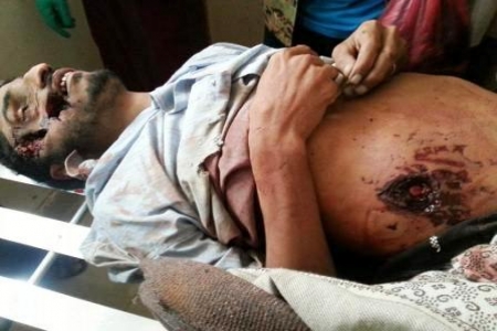 استشهاد مواطنين جراء قصف قوات الجيش اليمني التابعة للواء 135 المتمركز في الملاح  بردفان بالمدفعية
