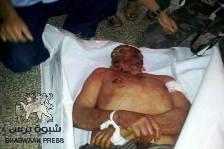شهيد وجرحى في الضالع وتوتر للوضع