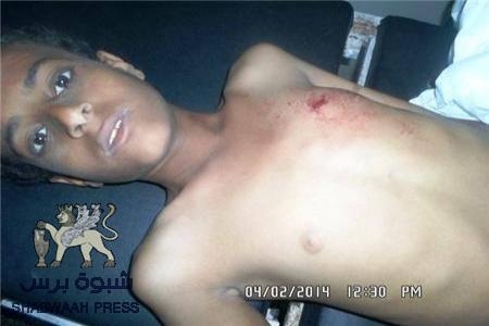 إصابة ثلاثة أشخاص بجروح  بينهم طفل في تجدد للقصف على أحياء وقرى الضالع