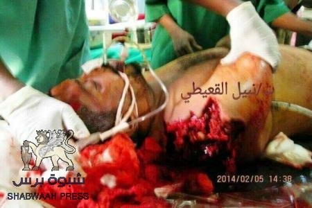 سقوط شهيد برصاص الدوشكا في منصورة عدن واقتحام لساحة الشهداء