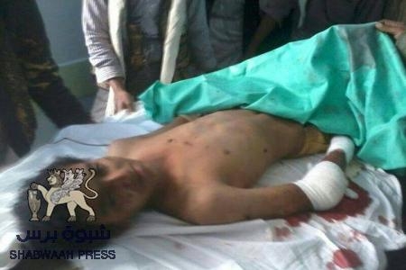 اصابة شابين في انفجار جسم غريب على طريق نصاب عتق و‘‘ شبوه برس‘‘ يحذر المواطنين