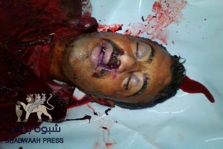 العثور على جثة شخص مقتولاً عقب قصف الجيش على الضالع