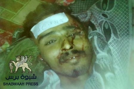 منظمة حقوقية في تقريرها : الجيش اليمني يرتكب جرائم حرب في جنوب اليمن
